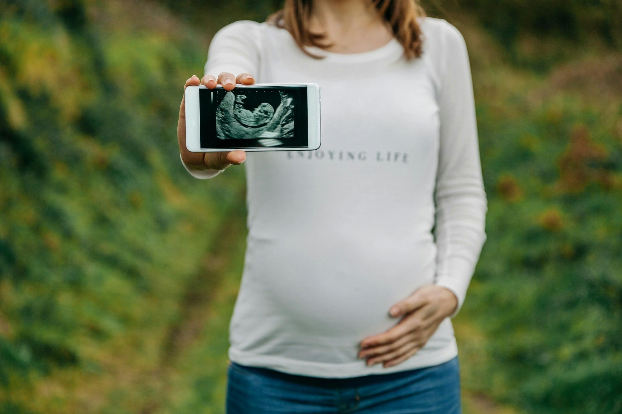 Pregnant showing ultrasound on the mobile